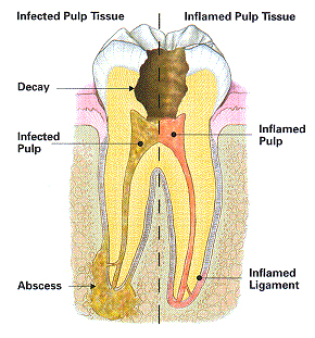 Endodontist in Ridgewood