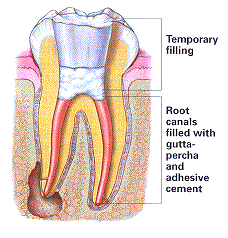 Endodontics in New City