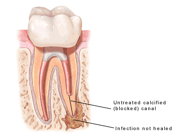Endodontics in New City