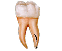 Endodontist in Ridgewood