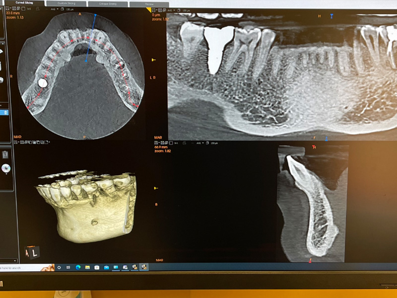 Endodontist in Ridgewood